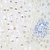 Immunohistochemistry of paraffin-embedded human esophagus using NEDD8 antibody (14-075) at dilution of 1:100 (40x lens) .