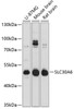 Western blot analysis of extracts of various cell lines, using SLC30A6 Antibody (14-081) at 1:3000 dilution.<br/>Secondary antibody: HRP Goat Anti-Rabbit IgG (H+L) at 1:10000 dilution.<br/>Lysates/proteins: 25ug per lane.<br/>Blocking buffer: 3% nonfat dry milk in TBST.<br/>Detection: ECL Basic Kit.<br/>Exposure time: 30s.