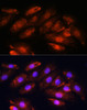 Immunofluorescence analysis of H9C2 cells using OTUB1 antibody (14-086) at dilution of 1:100. Blue: DAPI for nuclear staining.