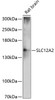 Western blot analysis of extracts of rat brain, using SLC12A2 antibody (14-095) at 1:3000 dilution.<br/>Secondary antibody: HRP Goat Anti-Rabbit IgG (H+L) at 1:10000 dilution.<br/>Lysates/proteins: 25ug per lane.<br/>Blocking buffer: 3% nonfat dry milk in TBST.<br/>Detection: ECL Basic Kit.<br/>Exposure time: 90s.