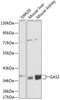 Western blot analysis of extracts of various cell lines, using GAS2 antibody (14-097) at 1:1000 dilution.<br/>Secondary antibody: HRP Goat Anti-Rabbit IgG (H+L) at 1:10000 dilution.<br/>Lysates/proteins: 25ug per lane.<br/>Blocking buffer: 3% nonfat dry milk in TBST.