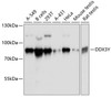 Western blot analysis of extracts of various cell lines, using DDX3Y antibody (14-107) at 1:3000 dilution.<br/>Secondary antibody: HRP Goat Anti-Rabbit IgG (H+L) at 1:10000 dilution.<br/>Lysates/proteins: 25ug per lane.<br/>Blocking buffer: 3% nonfat dry milk in TBST.<br/>Detection: ECL Basic Kit.<br/>Exposure time: 1s.