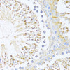 Immunohistochemistry of paraffin-embedded rat testis using DDX3Y antibody (14-107) at dilution of 1:100 (40x lens) .