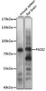 Western blot analysis of extracts of various cell lines, using PADI2 antibody (14-111) at 1:1000 dilution.<br/>Secondary antibody: HRP Goat Anti-Rabbit IgG (H+L) at 1:10000 dilution.<br/>Lysates/proteins: 25ug per lane.<br/>Blocking buffer: 3% nonfat dry milk in TBST.<br/>Detection: ECL Basic Kit.<br/>Exposure time: 3s.
