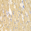 Immunohistochemistry of paraffin-embedded mouse heart using CAPN1 antibody (14-117) at dilution of 1:100 (40x lens) .