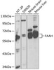 Western blot analysis of extracts of various cell lines, using FAAH antibody (14-124) at 1:1000 dilution.<br/>Secondary antibody: HRP Goat Anti-Rabbit IgG (H+L) at 1:10000 dilution.<br/>Lysates/proteins: 25ug per lane.<br/>Blocking buffer: 3% nonfat dry milk in TBST.