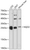 Western blot analysis of extracts of various cell lines, using NQO2 antibody (14-126) at 1:3000 dilution.<br/>Secondary antibody: HRP Goat Anti-Rabbit IgG (H+L) at 1:10000 dilution.<br/>Lysates/proteins: 25ug per lane.<br/>Blocking buffer: 3% nonfat dry milk in TBST.<br/>Detection: ECL Basic Kit.<br/>Exposure time: 90s.