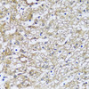 Immunohistochemistry of paraffin-embedded Human liver using NQO2 antibody (14-126) at dilution of 1:100 (40x lens) .