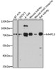 Western blot analysis of extracts of various cell lines, using MMP13 antibody (14-131) at 1:1000 dilution.<br/>Secondary antibody: HRP Goat Anti-Rabbit IgG (H+L) at 1:10000 dilution.<br/>Lysates/proteins: 25ug per lane.<br/>Blocking buffer: 3% nonfat dry milk in TBST.<br/>Detection: ECL Enhanced Kit.<br/>Exposure time: 90s.