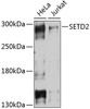 Western blot analysis of extracts of various cell lines, using SETD2 Antibody (14-132) at 1:1000 dilution.<br/>Secondary antibody: HRP Goat Anti-Rabbit IgG (H+L) at 1:10000 dilution.<br/>Lysates/proteins: 25ug per lane.<br/>Blocking buffer: 3% nonfat dry milk in TBST.<br/>Detection: ECL Basic Kit.<br/>Exposure time: 15s.