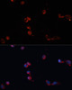 Immunofluorescence analysis of HeLa cells using CAT antibody (14-138) at dilution of 1:100. Blue: DAPI for nuclear staining.