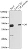 Immunoprecipitation analysis of 100ug extracts of HepG2 cells using 3ug CAT antibody (14-140) . Western blot was performed from the immunoprecipitate using CAT antibody (14-140) at a dilition of 1:1000.
