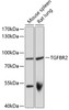 Western blot analysis of extracts of various cell lines, using TGFBR2 antibody (14-143) at 1:1000 dilution.<br/>Secondary antibody: HRP Goat Anti-Rabbit IgG (H+L) at 1:10000 dilution.<br/>Lysates/proteins: 25ug per lane.<br/>Blocking buffer: 3% nonfat dry milk in TBST.<br/>Detection: ECL Basic Kit.<br/>Exposure time: 1s.