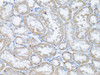 Immunohistochemistry of paraffin-embedded rat kidney using SNAIL antibody (14-144) at dilution of 1:100 (40x lens) .