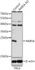 Western blot analysis of extracts from normal (control) and RAB5A knockout (KO) HeLa cells, using RAB5A antibody (14-146) at 1:1000 dilution.<br/>Secondary antibody: HRP Goat Anti-Rabbit IgG (H+L) at 1:10000 dilution.<br/>Lysates/proteins: 25ug per lane.<br/>Blocking buffer: 3% nonfat dry milk in TBST.<br/>Detection: ECL Basic Kit.<br/>Exposure time: 15s.