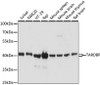 Immunohistochemistry of paraffin-embedded human esophagus using TARDBP Antibody (14-156) at dilution of 1:200 (40x lens) .