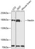 Western blot analysis of extracts of various cell lines, using Nestin antibody (14-175) at 1:3000 dilution.<br/>Secondary antibody: HRP Goat Anti-Rabbit IgG (H+L) at 1:10000 dilution.<br/>Lysates/proteins: 25ug per lane.<br/>Blocking buffer: 3% nonfat dry milk in TBST.<br/>Detection: ECL Basic Kit.<br/>Exposure time: 90s.