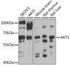 Western blot analysis of extracts of various cell lines, using AKT1 antibody (14-185) at 1:1000 dilution.<br/>Secondary antibody: HRP Goat Anti-Rabbit IgG (H+L) at 1:10000 dilution.<br/>Lysates/proteins: 25ug per lane.<br/>Blocking buffer: 3% nonfat dry milk in TBST.<br/>Detection: ECL Basic Kit.<br/>Exposure time: 10s.