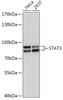 Western blot analysis of extracts of various cell lines, using STAT3 antibody (14-190) at 1:1000 dilution.<br/>Secondary antibody: HRP Goat Anti-Rabbit IgG (H+L) at 1:10000 dilution.<br/>Lysates/proteins: 25ug per lane.<br/>Blocking buffer: 3% nonfat dry milk in TBST.<br/>Detection: ECL Basic Kit.<br/>Exposure time: 90s.