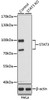 Western blot analysis of extracts from normal (control) and STAT3 knockout (KO) HeLa cells, using STAT3 antibody (14-190) at 1:1000 dilution.<br/>Secondary antibody: HRP Goat Anti-Rabbit IgG (H+L) at 1:10000 dilution.<br/>Lysates/proteins: 25ug per lane.<br/>Blocking buffer: 3% nonfat dry milk in TBST.<br/>Detection: ECL Basic Kit.<br/>Exposure time: 30s.