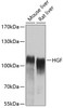 Western blot analysis of extracts of various cell lines, using HGF antibody (14-198) at 1:400 dilution.<br/>Secondary antibody: HRP Goat Anti-Rabbit IgG (H+L) at 1:10000 dilution.<br/>Lysates/proteins: 25ug per lane.<br/>Blocking buffer: 3% nonfat dry milk in TBST.<br/>Detection: ECL Enhanced Kit.<br/>Exposure time: 60s.