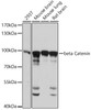 Western blot analysis of extracts of various cell lines, using beta Catenin antibody (14-200) at 1:3000 dilution.<br/>Secondary antibody: HRP Goat Anti-Rabbit IgG (H+L) at 1:10000 dilution.<br/>Lysates/proteins: 25ug per lane.<br/>Blocking buffer: 3% nonfat dry milk in TBST.<br/>Detection: ECL Basic Kit.<br/>Exposure time: 10s.