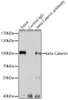 Immunoprecipitation analysis of 200ug extracts of U-87MG cells using 3ug beta Catenin antibody (14-200) . Western blot was performed from the immunoprecipitate using beta Catenin antibody (14-200) at a dilition of 1:1000.