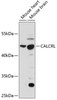 Western blot analysis of extracts of various cell lines, using CALCRL antibody (14-214) at 1:1000 dilution.<br/>Secondary antibody: HRP Goat Anti-Rabbit IgG (H+L) at 1:10000 dilution.<br/>Lysates/proteins: 25ug per lane.<br/>Blocking buffer: 3% nonfat dry milk in TBST.<br/>Detection: ECL Basic Kit.<br/>Exposure time: 90s.