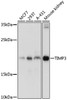 Western blot analysis of extracts of various cell lines, using TIMP3 antibody (14-217) at 1:1000 dilution.<br/>Secondary antibody: HRP Goat Anti-Rabbit IgG (H+L) at 1:10000 dilution.<br/>Lysates/proteins: 25ug per lane.<br/>Blocking buffer: 3% nonfat dry milk in TBST.<br/>Detection: ECL Basic Kit.<br/>Exposure time: 3min.