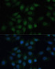 Immunofluorescence analysis of HeLa cells using CREB1 antibody (14-218) at dilution of 1:100. Blue: DAPI for nuclear staining.
