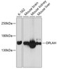 Western blot analysis of extracts of various cell lines, using OPLAH antibody (14-232) at 1:3000 dilution.<br/>Secondary antibody: HRP Goat Anti-Rabbit IgG (H+L) at 1:10000 dilution.<br/>Lysates/proteins: 25ug per lane.<br/>Blocking buffer: 3% nonfat dry milk in TBST.<br/>Detection: ECL Basic Kit.<br/>Exposure time: 1s.