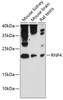 Western blot analysis of extracts of various cell lines, using RNF4 antibody (14-233) at 1:3000 dilution.<br/>Secondary antibody: HRP Goat Anti-Rabbit IgG (H+L) at 1:10000 dilution.<br/>Lysates/proteins: 25ug per lane.<br/>Blocking buffer: 3% nonfat dry milk in TBST.<br/>Detection: ECL Enhanced Kit.<br/>Exposure time: 90s.