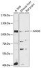 Western blot analysis of extracts of various cell lines, using ANO6 antibody (14-239) at 1:3000 dilution.<br/>Secondary antibody: HRP Goat Anti-Rabbit IgG (H+L) at 1:10000 dilution.<br/>Lysates/proteins: 25ug per lane.<br/>Blocking buffer: 3% nonfat dry milk in TBST.<br/>Detection: ECL Basic Kit.<br/>Exposure time: 90s.