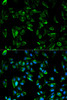 Immunofluorescence analysis of HeLa cells using TPM3 antibody (14-242) . Blue: DAPI for nuclear staining.