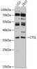 Western blot analysis of extracts of various cell lines, using CTSL antibody (14-245) at 1:3000 dilution.<br/>Secondary antibody: HRP Goat Anti-Rabbit IgG (H+L) at 1:10000 dilution.<br/>Lysates/proteins: 25ug per lane.<br/>Blocking buffer: 3% nonfat dry milk in TBST.<br/>Detection: ECL Basic Kit.<br/>Exposure time: 90s.
