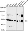 Western blot analysis of extracts of various cell lines, using GSR antibody (14-247) at 1:3000 dilution.<br/>Secondary antibody: HRP Goat Anti-Rabbit IgG (H+L) at 1:10000 dilution.<br/>Lysates/proteins: 25ug per lane.<br/>Blocking buffer: 3% nonfat dry milk in TBST.<br/>Detection: ECL Basic Kit.<br/>Exposure time: 10s.