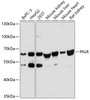 Western blot analysis of extracts of various cell lines, using PKLR antibody (14-251) at 1:3000 dilution.<br/>Secondary antibody: HRP Goat Anti-Rabbit IgG (H+L) at 1:10000 dilution.<br/>Lysates/proteins: 25ug per lane.<br/>Blocking buffer: 3% nonfat dry milk in TBST.<br/>Detection: ECL Basic Kit.<br/>Exposure time: 50s.