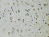 Immunohistochemistry of paraffin-embedded rat brain using UGDH antibody (14-260) at dilution of 1:100 (40x lens) .