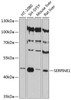 Western blot analysis of extracts of various cell lines, using SERPINE1 antibody (14-262) at 1:3000 dilution.<br/>Secondary antibody: HRP Goat Anti-Rabbit IgG (H+L) at 1:10000 dilution.<br/>Lysates/proteins: 25ug per lane.<br/>Blocking buffer: 3% nonfat dry milk in TBST.<br/>Detection: ECL Basic Kit.<br/>Exposure time: 40s.