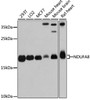 Western blot analysis of extracts of various cell lines, using NDUFA8 antibody (14-265) at 1:3000 dilution.<br/>Secondary antibody: HRP Goat Anti-Rabbit IgG (H+L) at 1:10000 dilution.<br/>Lysates/proteins: 25ug per lane.<br/>Blocking buffer: 3% nonfat dry milk in TBST.<br/>Detection: ECL Basic Kit.<br/>Exposure time: 30s.
