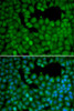 Immunofluorescence analysis of HeLa cells using NET1 antibody (14-270) . Blue: DAPI for nuclear staining.