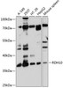 Western blot analysis of extracts of various cell lines, using RDH10 antibody (14-272) at 1:1000 dilution.<br/>Secondary antibody: HRP Goat Anti-Rabbit IgG (H+L) at 1:10000 dilution.<br/>Lysates/proteins: 25ug per lane.<br/>Blocking buffer: 3% nonfat dry milk in TBST.<br/>Detection: ECL Basic Kit.<br/>Exposure time: 10s.