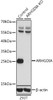 Western blot analysis of extracts from normal (control) and ARHGDIA knockout (KO) 293T cells, using ARHGDIA antibody (14-275) at 1:1000 dilution.<br/>Secondary antibody: HRP Goat Anti-Rabbit IgG (H+L) at 1:10000 dilution.<br/>Lysates/proteins: 25ug per lane.<br/>Blocking buffer: 3% nonfat dry milk in TBST.<br/>Detection: ECL Basic Kit.<br/>Exposure time: 10s.