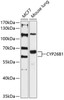 Western blot analysis of extracts of various cell lines, using CYP26B1 antibody (14-277) at 1:3000 dilution.<br/>Secondary antibody: HRP Goat Anti-Rabbit IgG (H+L) at 1:10000 dilution.<br/>Lysates/proteins: 25ug per lane.<br/>Blocking buffer: 3% nonfat dry milk in TBST.<br/>Detection: ECL Enhanced Kit.<br/>Exposure time: 90s.