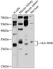 Western blot analysis of extracts of various cell lines, using HLA-DOB antibody (14-282) at 1:3000 dilution.<br/>Secondary antibody: HRP Goat Anti-Rabbit IgG (H+L) at 1:10000 dilution.<br/>Lysates/proteins: 25ug per lane.<br/>Blocking buffer: 3% nonfat dry milk in TBST.<br/>Detection: ECL Enhanced Kit.<br/>Exposure time: 90s.