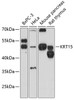 Western blot analysis of extracts of various cell lines, using KRT15 antibody (14-283) at 1:3000 dilution.<br/>Secondary antibody: HRP Goat Anti-Rabbit IgG (H+L) at 1:10000 dilution.<br/>Lysates/proteins: 25ug per lane.<br/>Blocking buffer: 3% nonfat dry milk in TBST.<br/>Detection: ECL Basic Kit.<br/>Exposure time: 90s.