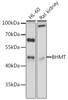 Western blot analysis of extracts of various cell lines, using BHMT antibody (14-286) at 1:1000 dilution.<br/>Secondary antibody: HRP Goat Anti-Rabbit IgG (H+L) at 1:10000 dilution.<br/>Lysates/proteins: 25ug per lane.<br/>Blocking buffer: 3% nonfat dry milk in TBST.<br/>Detection: ECL Basic Kit.<br/>Exposure time: 3s.
