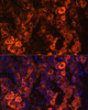 Immunofluorescence analysis of human liver cancer cells using BHMT antibody (14-286) at dilution of 1:100. Blue: DAPI for nuclear staining.