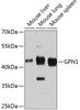 Western blot analysis of extracts of various cell lines, using GPN1 antibody (14-290) at 1:3000 dilution.<br/>Secondary antibody: HRP Goat Anti-Rabbit IgG (H+L) at 1:10000 dilution.<br/>Lysates/proteins: 25ug per lane.<br/>Blocking buffer: 3% nonfat dry milk in TBST.<br/>Detection: ECL Basic Kit.<br/>Exposure time: 90s.