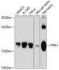 Western blot analysis of extracts of various cell lines, using PPIH antibody (14-294) at 1:3000 dilution.<br/>Secondary antibody: HRP Goat Anti-Rabbit IgG (H+L) at 1:10000 dilution.<br/>Lysates/proteins: 25ug per lane.<br/>Blocking buffer: 3% nonfat dry milk in TBST.<br/>Detection: ECL Basic Kit.<br/>Exposure time: 60s.